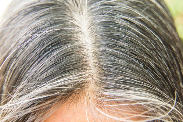 are-you-also-bothered-by-white-and-falling-hair?-so-adopt-this-simple-remedy-of-household-oil